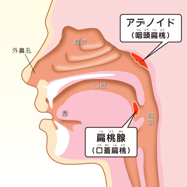 Image of