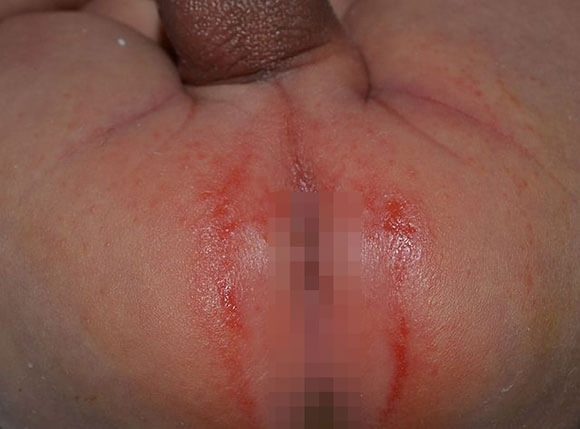 Image of