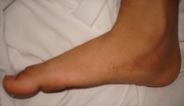 Image of