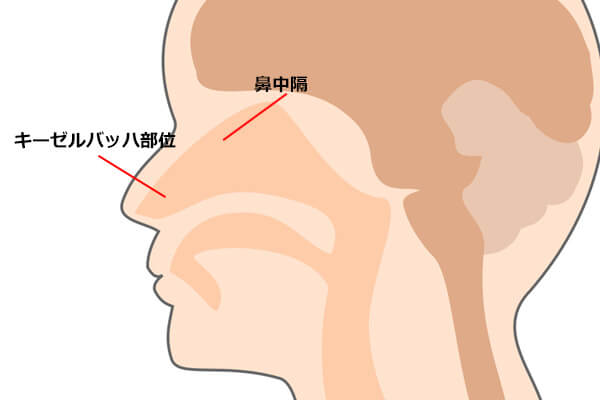 Image of 20a5ac595c84839cf727882db95b88e6 20a5ac595c84839cf727882db95b88e6