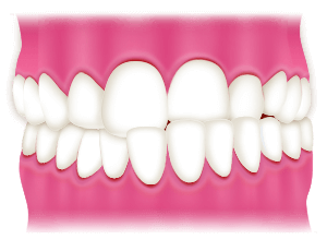 Image of 7b4ab6272a0f11b9987349c0a76aebd3 7b4ab6272a0f11b9987349c0a76aebd3