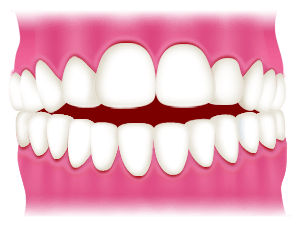 Image of aba0b4c277eaf28a2bd3dd9d1215e134 aba0b4c277eaf28a2bd3dd9d1215e134
