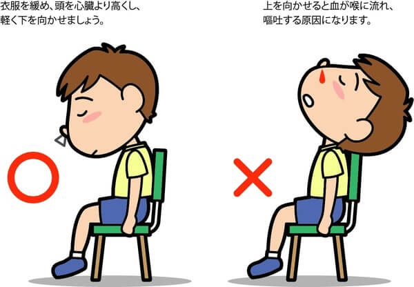 急に鼻血がたときの対処法